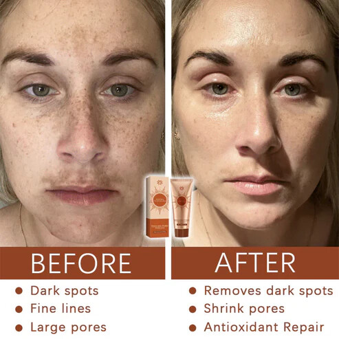 SkinLume™ Herbal Peel-Off Mask